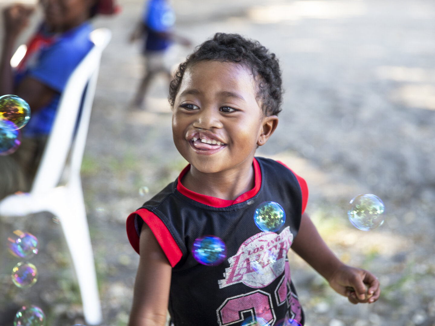 Leana, 2 years old, plays with bubbles at a surgical program in Madagascar. She received cleft care from Operation Smile.