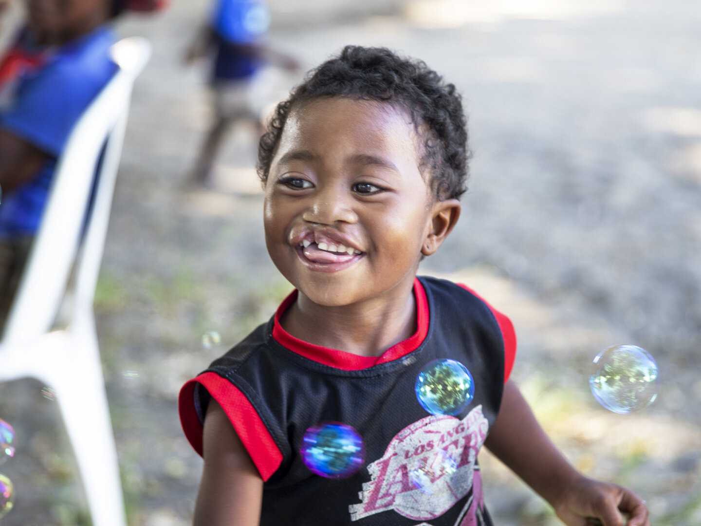 Leana, 2 years old, plays with bubbles at a surgical program in Madagascar.