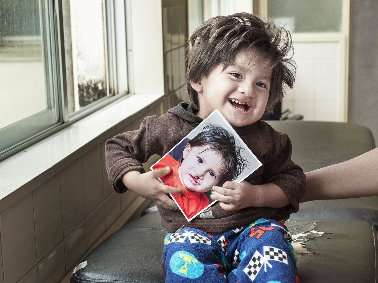 Damian, after surgery.