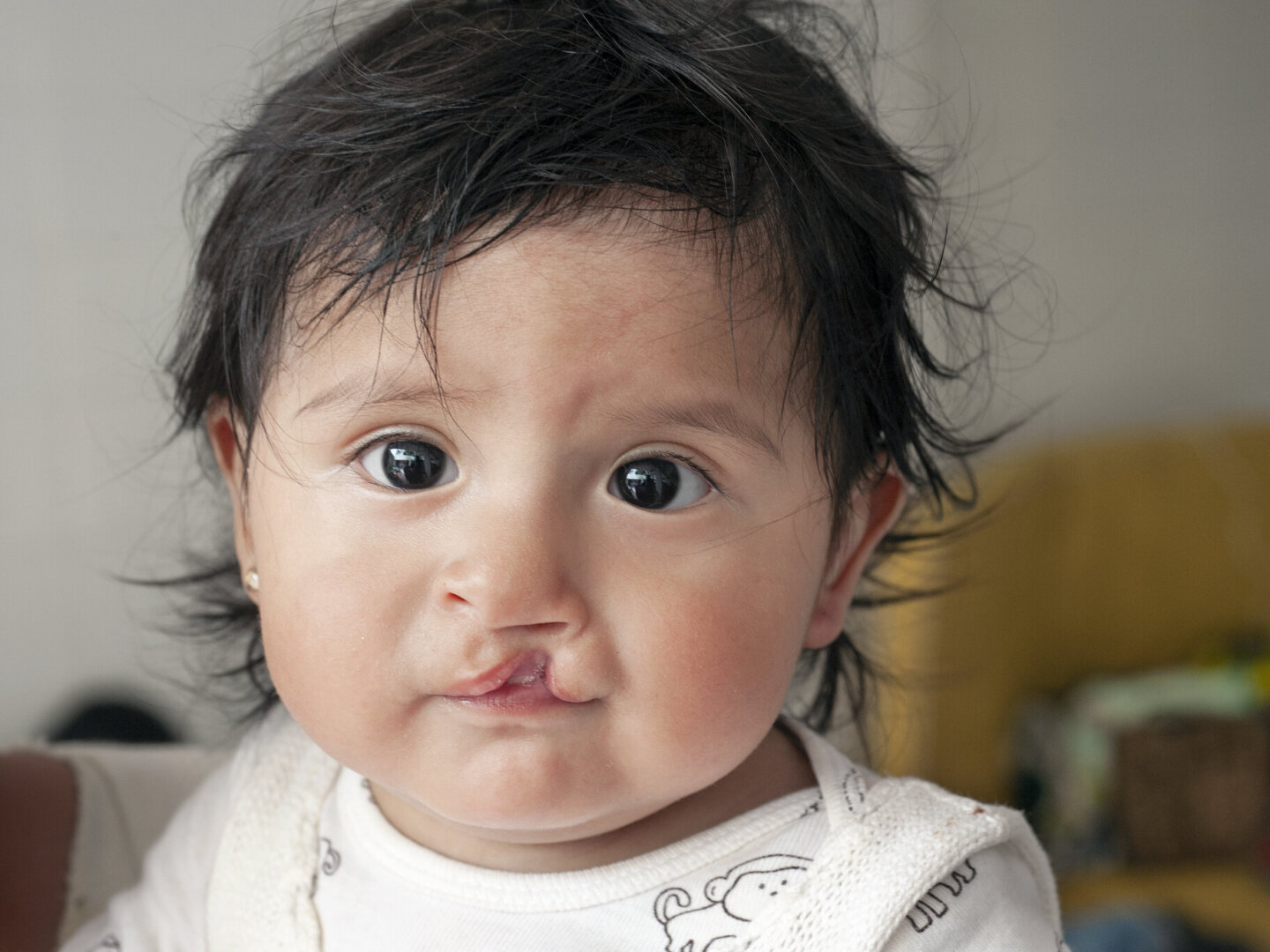 Heydi, before surgery.