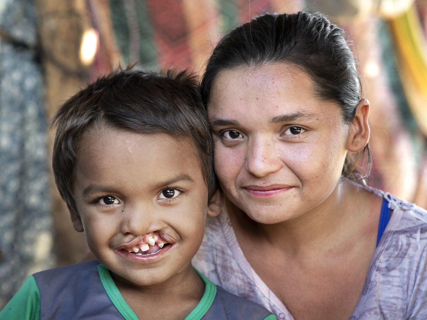 Pedro poses with his mother. He received treatment for his cleft lip and palate from Operation Smile.