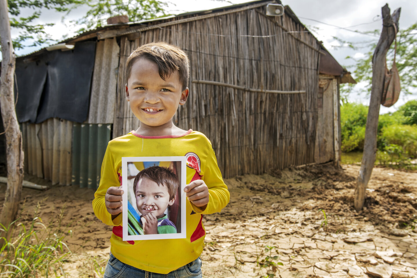 Pedro, after surgery.