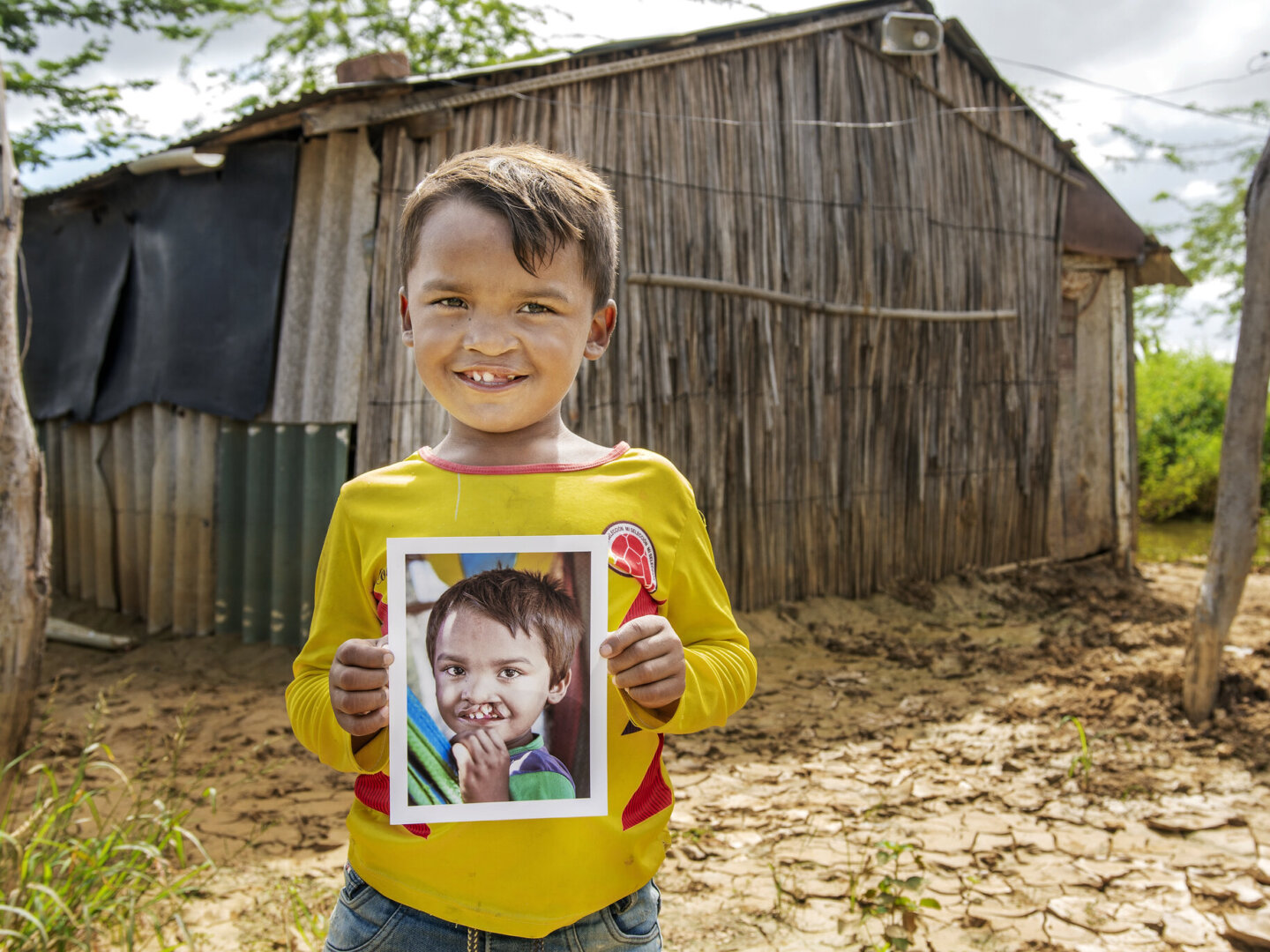 Pedro, after surgery.