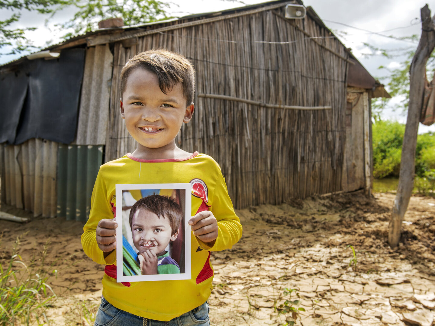 Pedro, after surgery.