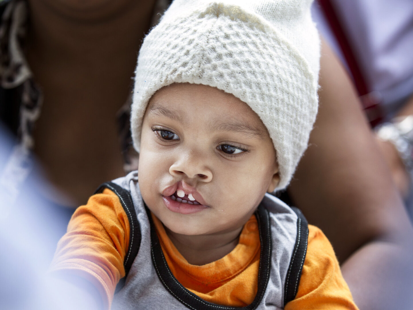 Leudy, before surgery.