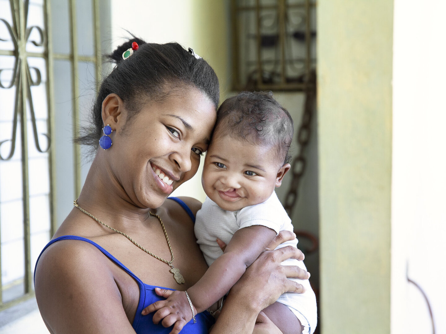 Jose, before surgery.