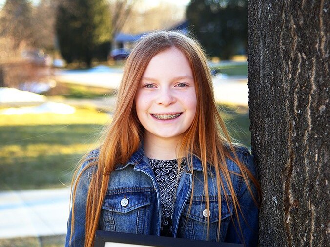 Elizabeth smiles with a photo of her as a baby, before her cleft surgery.