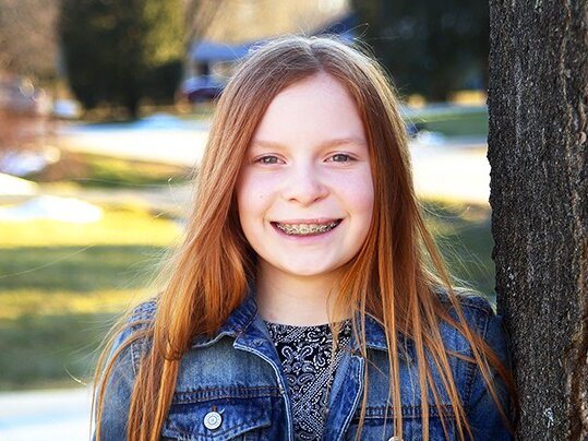 Elizabeth smiles with a photo of her as a baby, before her cleft surgery.