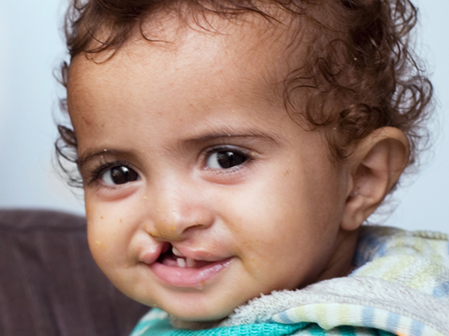 Fatima, before surgery.