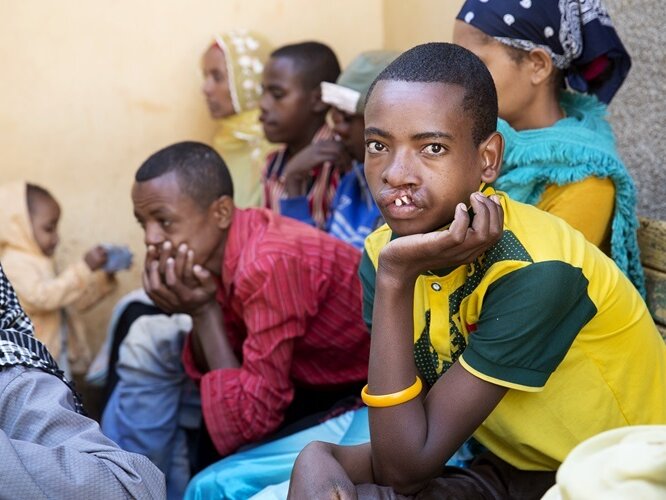 Asagim, before surgery.