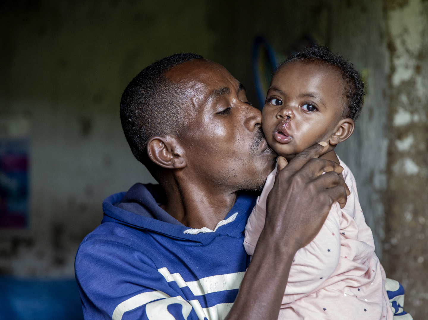 Samrawit, after surgery.