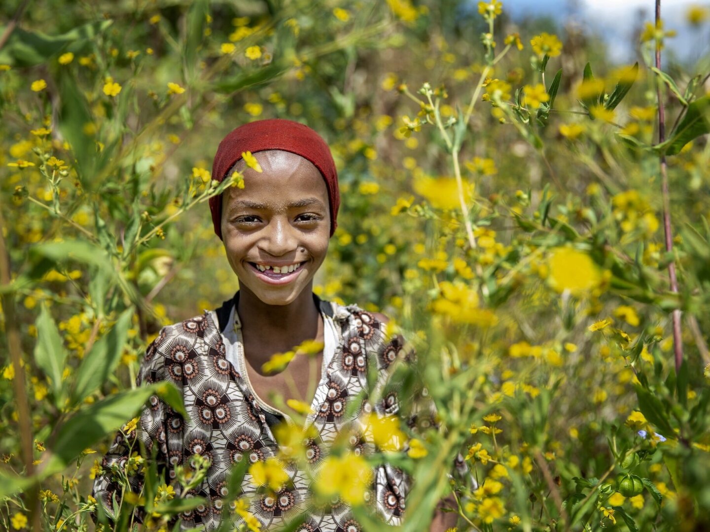 Nazifa, after surgery.