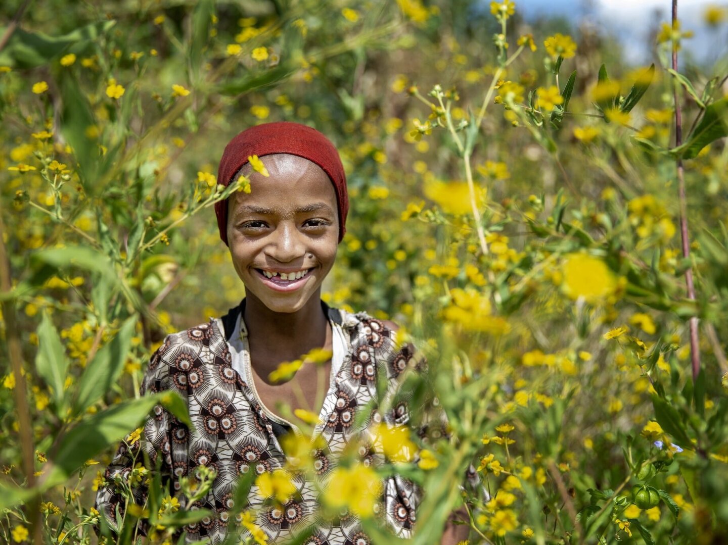 Nazifa, after surgery.