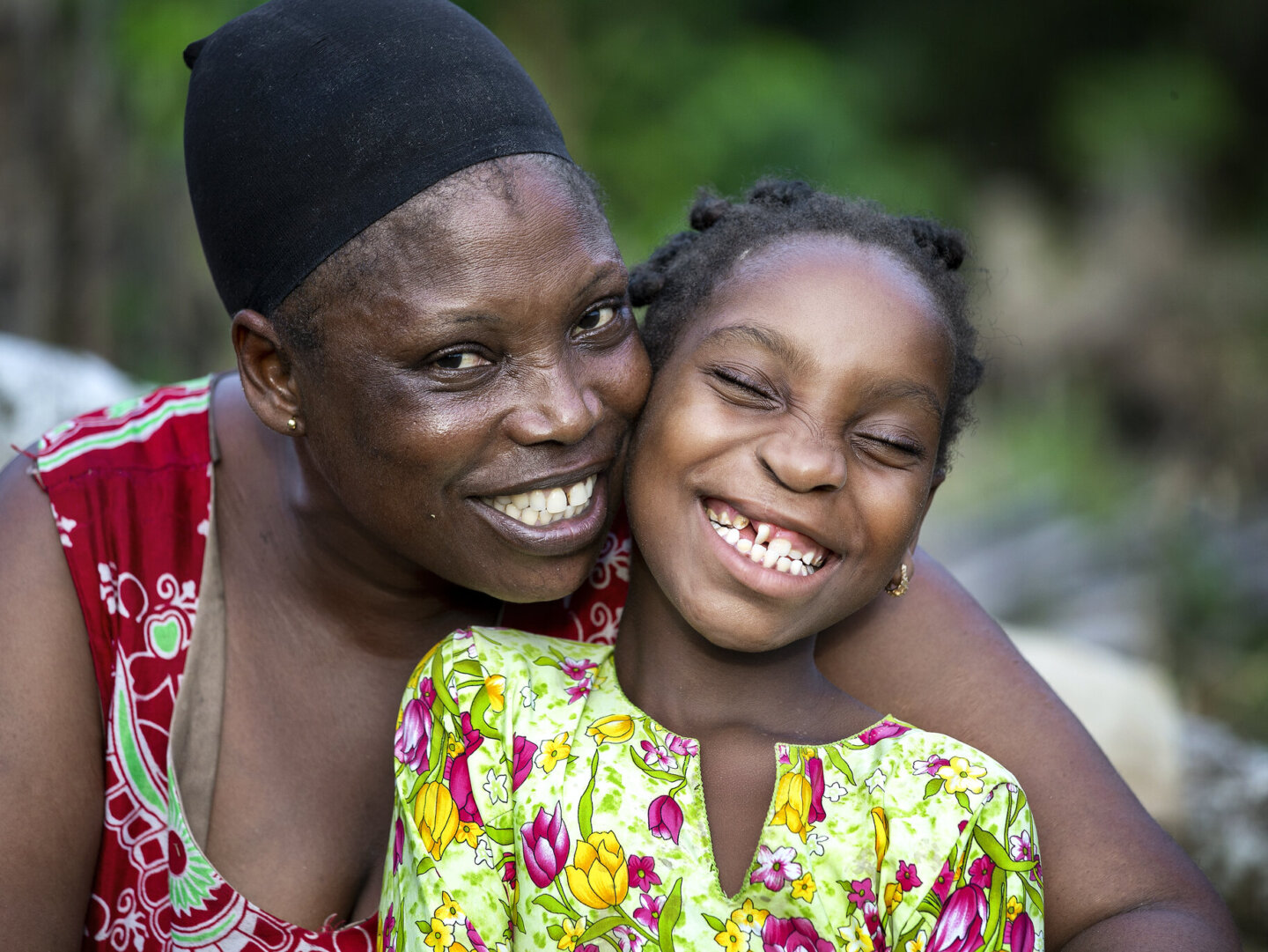Ramata poses with her mother, Mariana, after surgery.