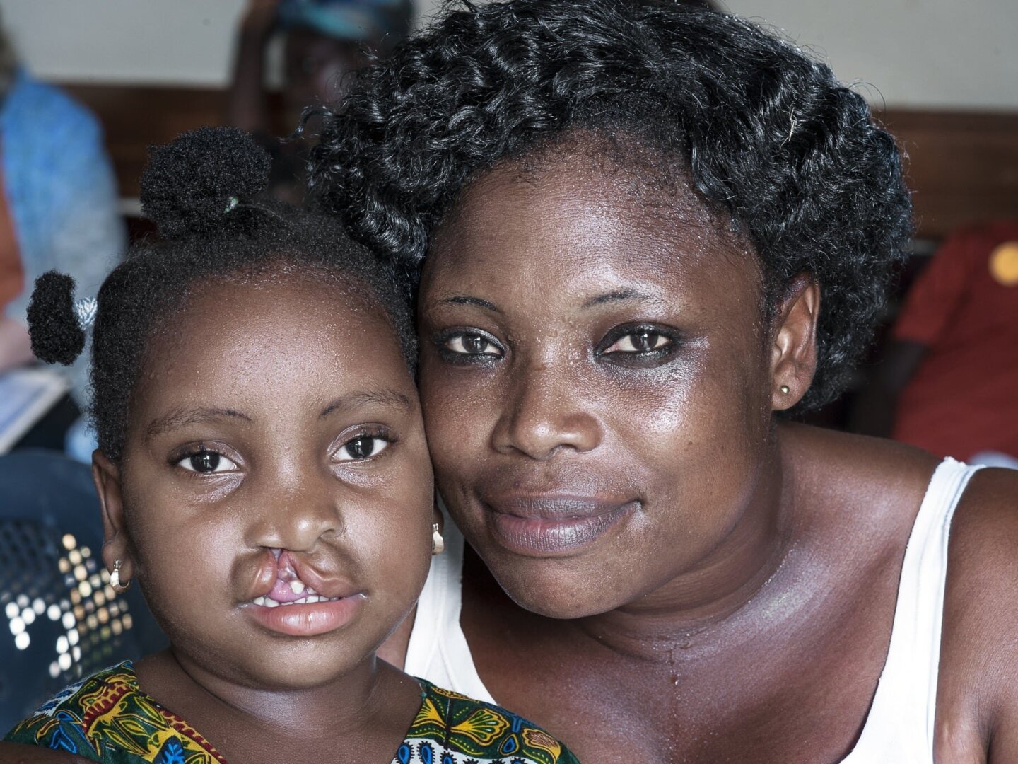 Ramata and Mariana, before Ramata's surgery.