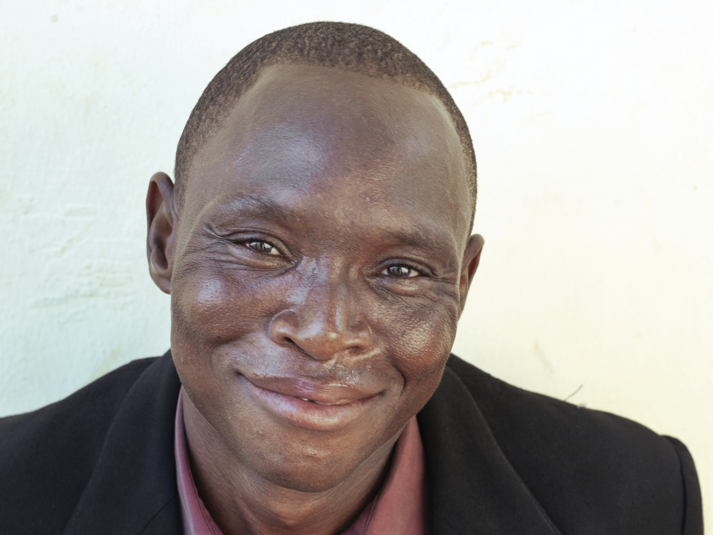 Seth smiles after surgery.