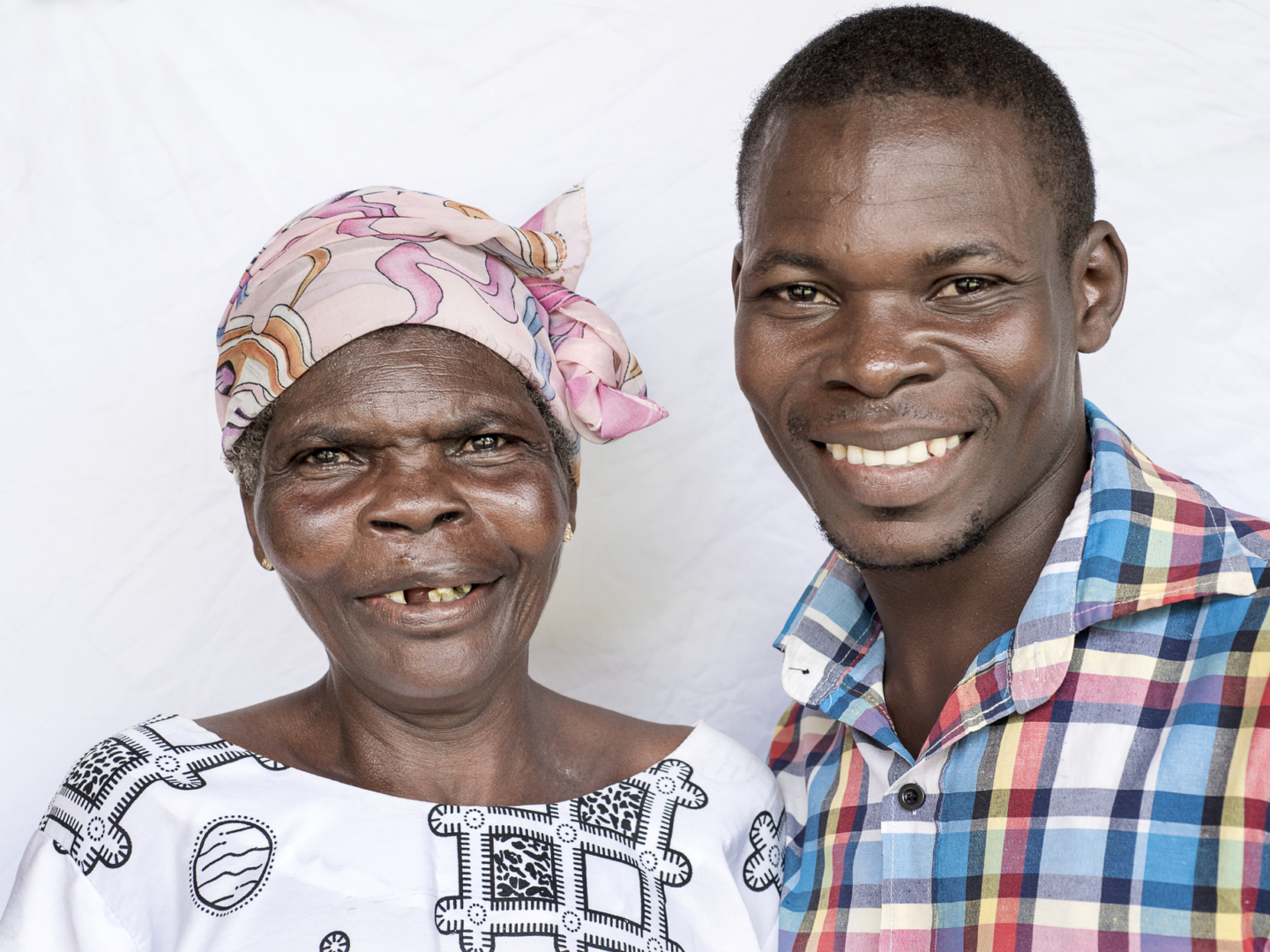 Yohana, one year after surgery.