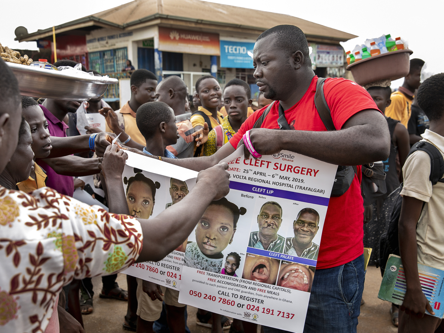 Operation Smile Ghana’s patient coordinator Clement Ofosuhemeng uses flyers and informational posters to conduct cleft awareness and patient recruitment campaigns across Ghana.
