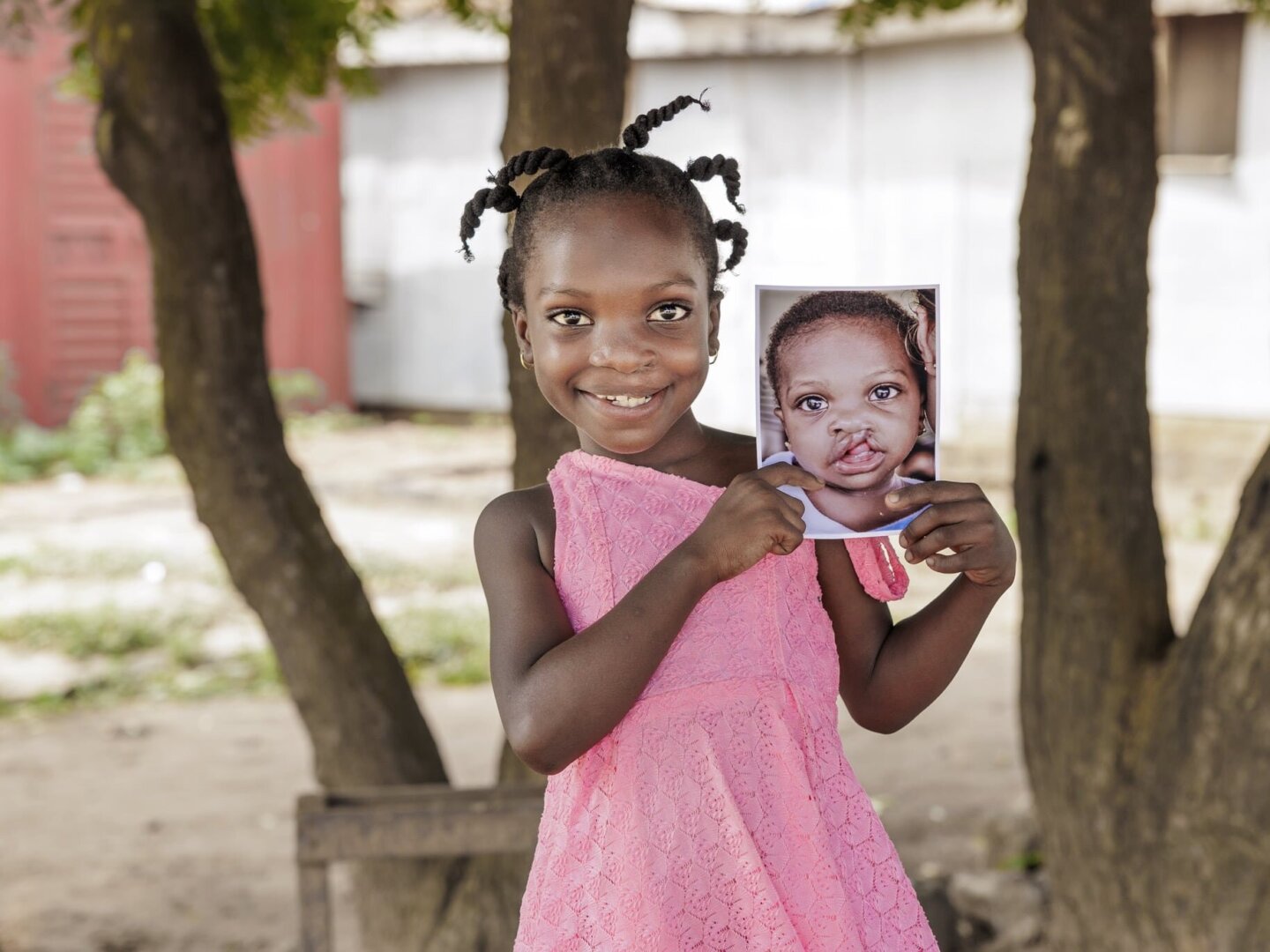 Shine smiles with her before photo.