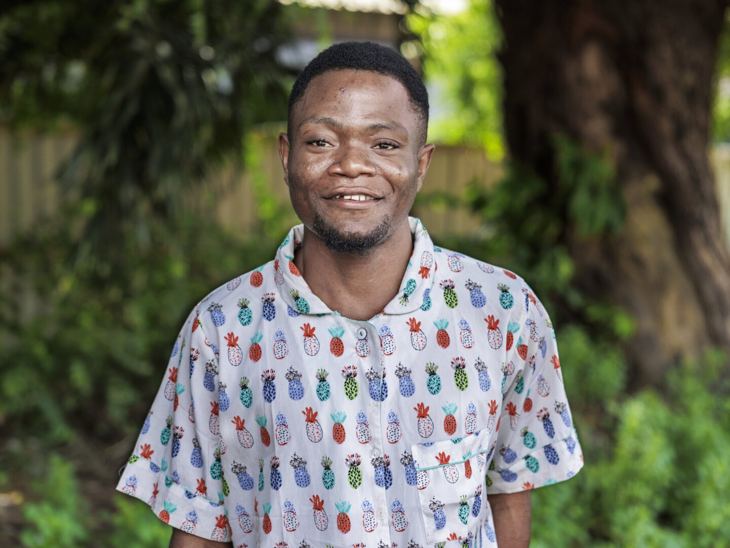 Samuel smiles for the camera after surgery.