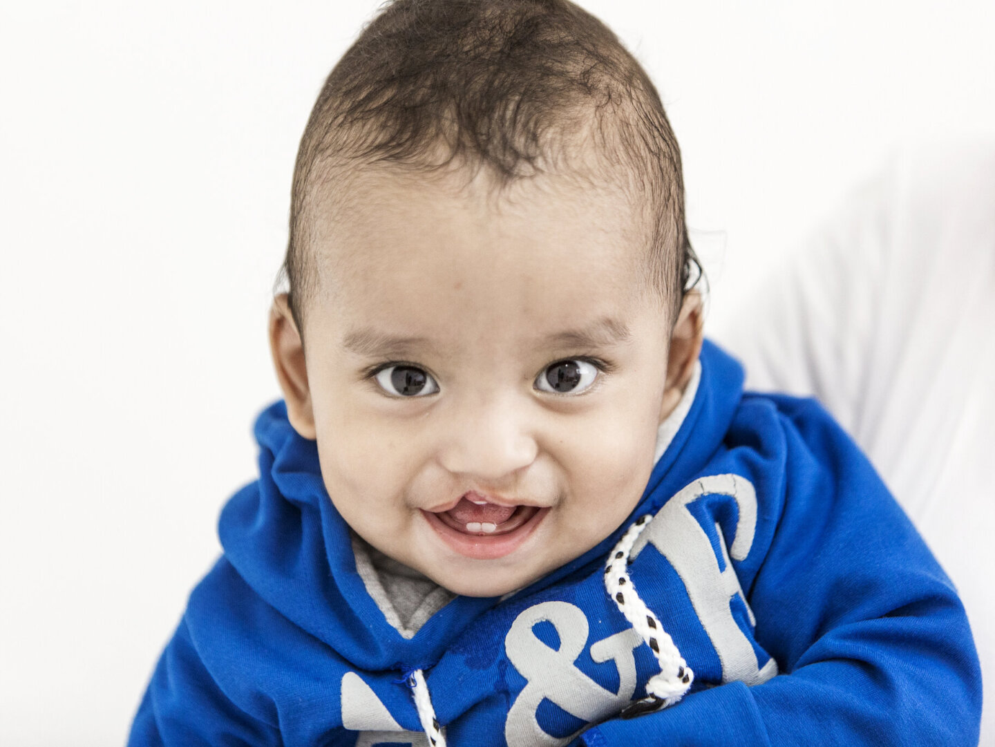 Ethan, 11 months old, smiles before surgery during a 2018 surgical mission in Guatemala City.