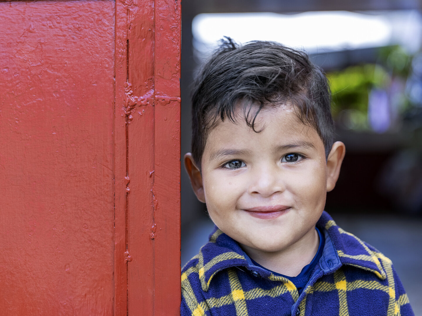 Four-year-old Dilan, after surgery.