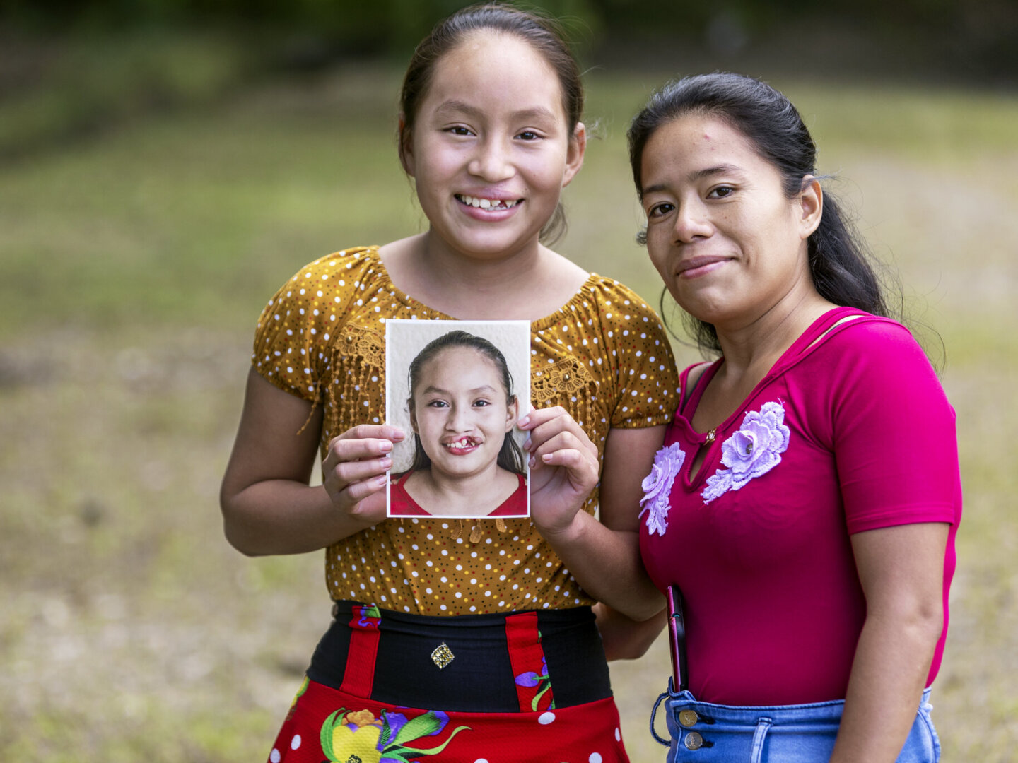 Dayana and her mom, after surgery.