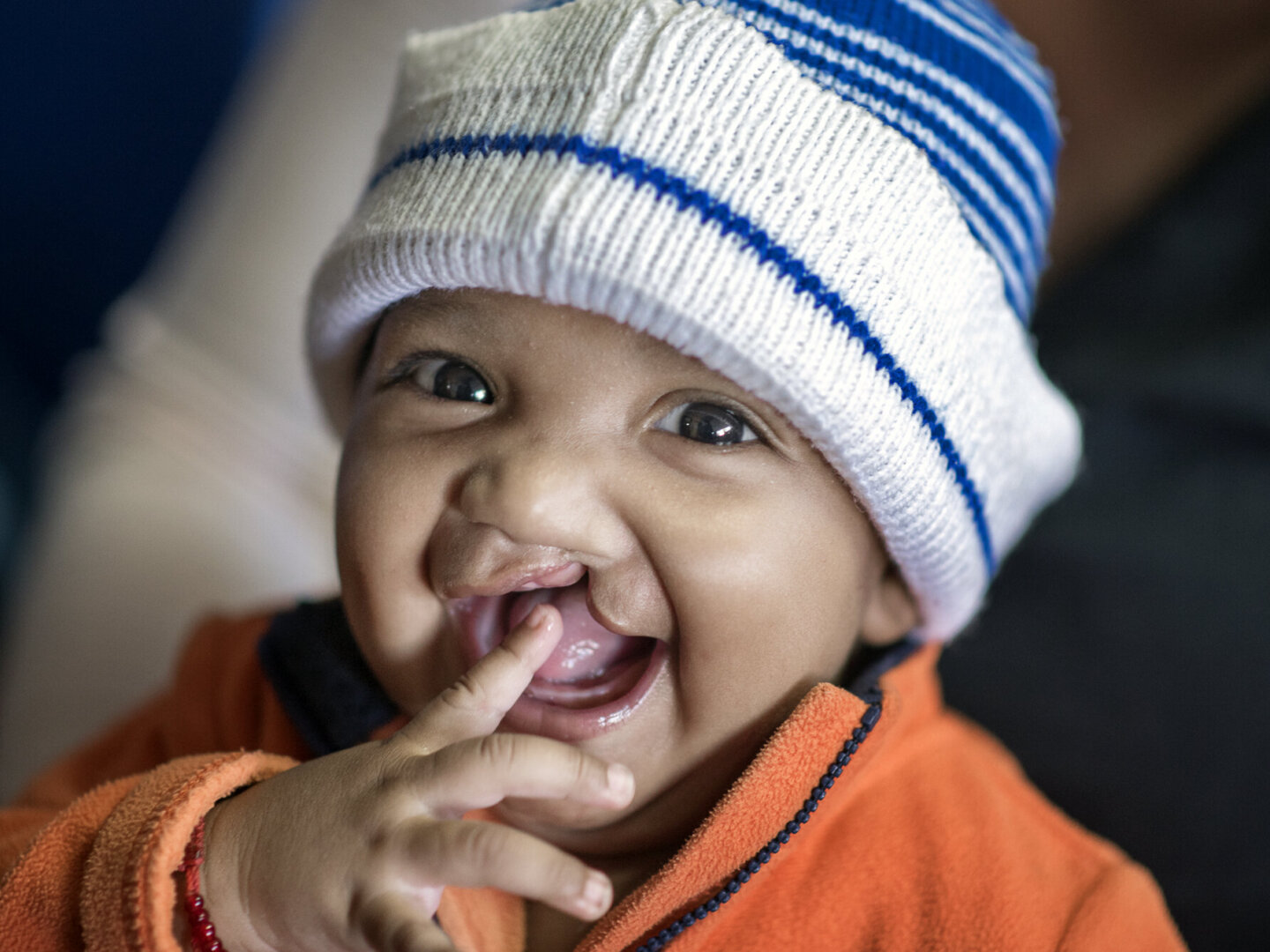 Erick, before surgery