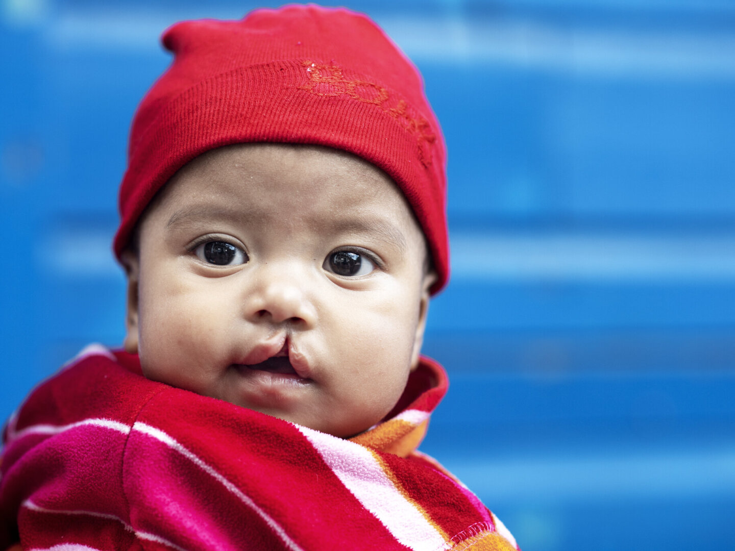 Genesis, before surgery.