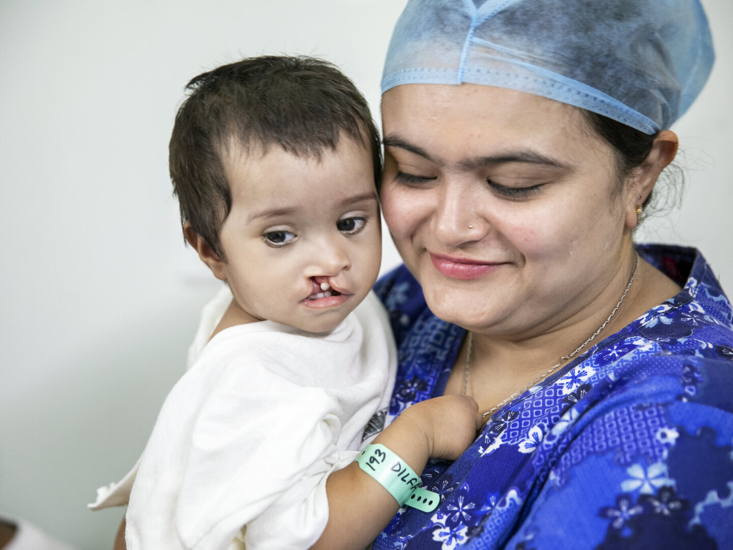 In 2018, Dilfa and her family connected with the local Operation Smile volunteer team in India who provided her with a surgery that would forever change her life.