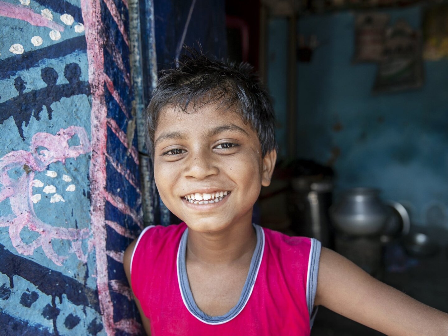 Bipul smiles, after surgery.