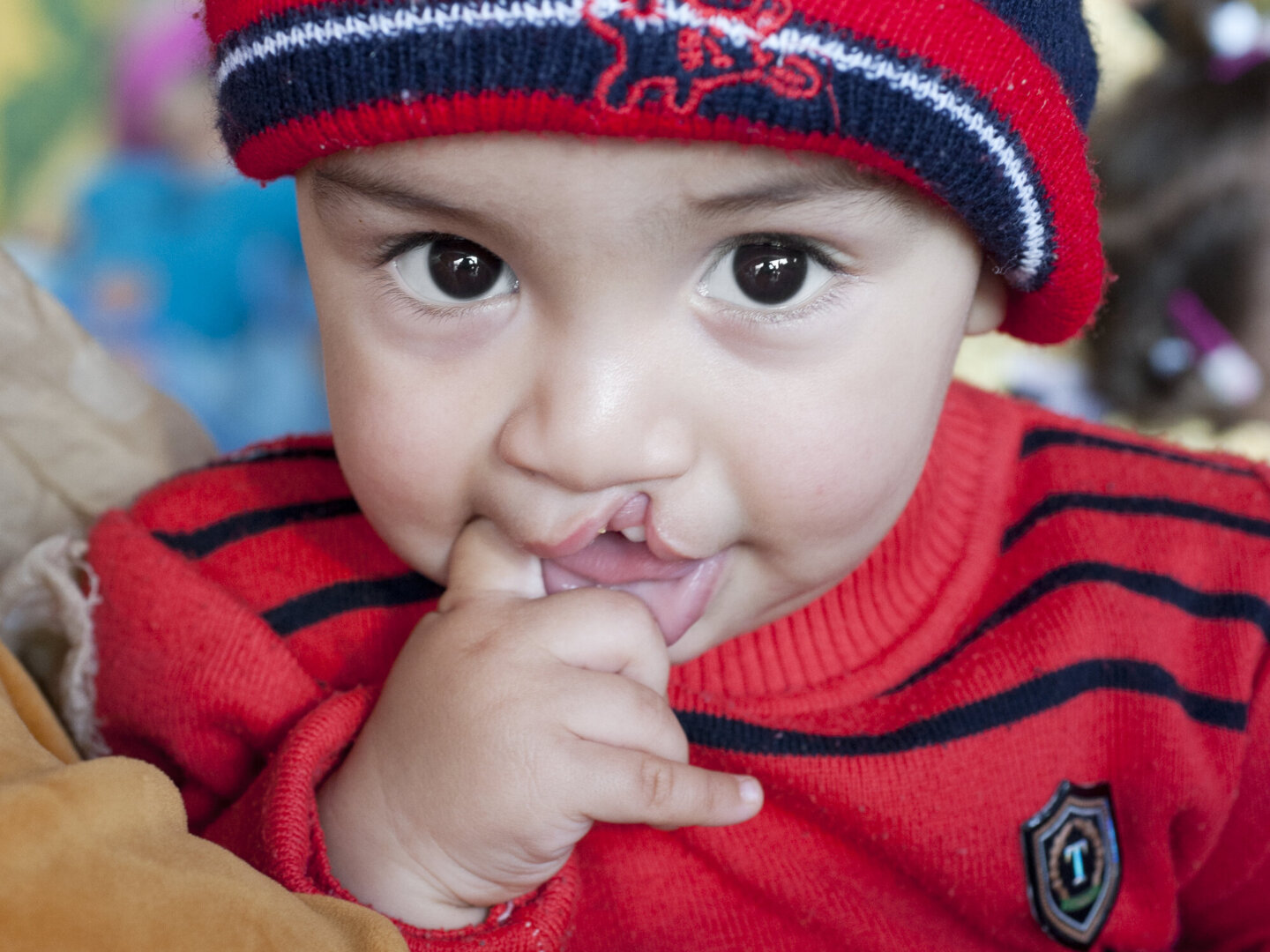 Mosslim looks at the camera during a surgical program in Morocco in 2015.