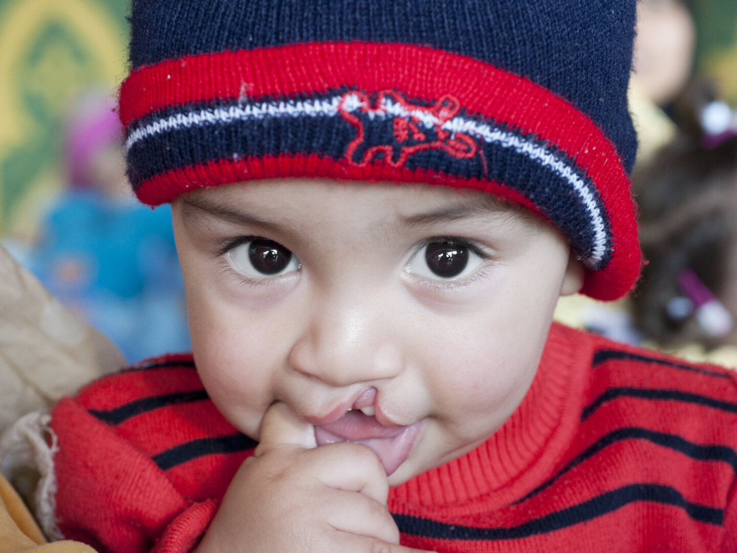 Mosslim looks at the camera during a surgical program in Morocco in 2015.
