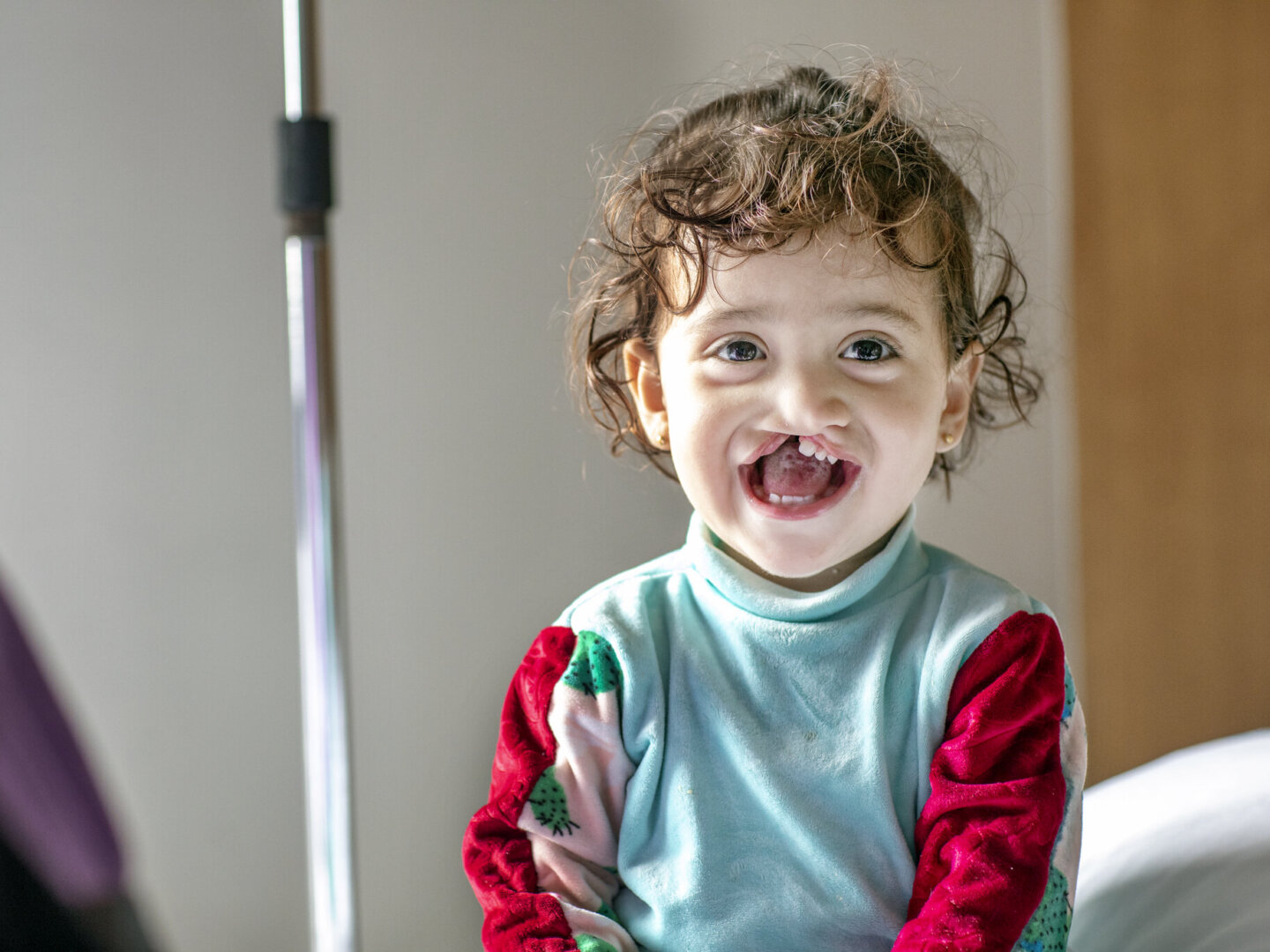 Janat, now almost 2 years old, shares her biggest smile during screening at Operation Smile Morocco’s October 2021 surgical program in Casablanca.