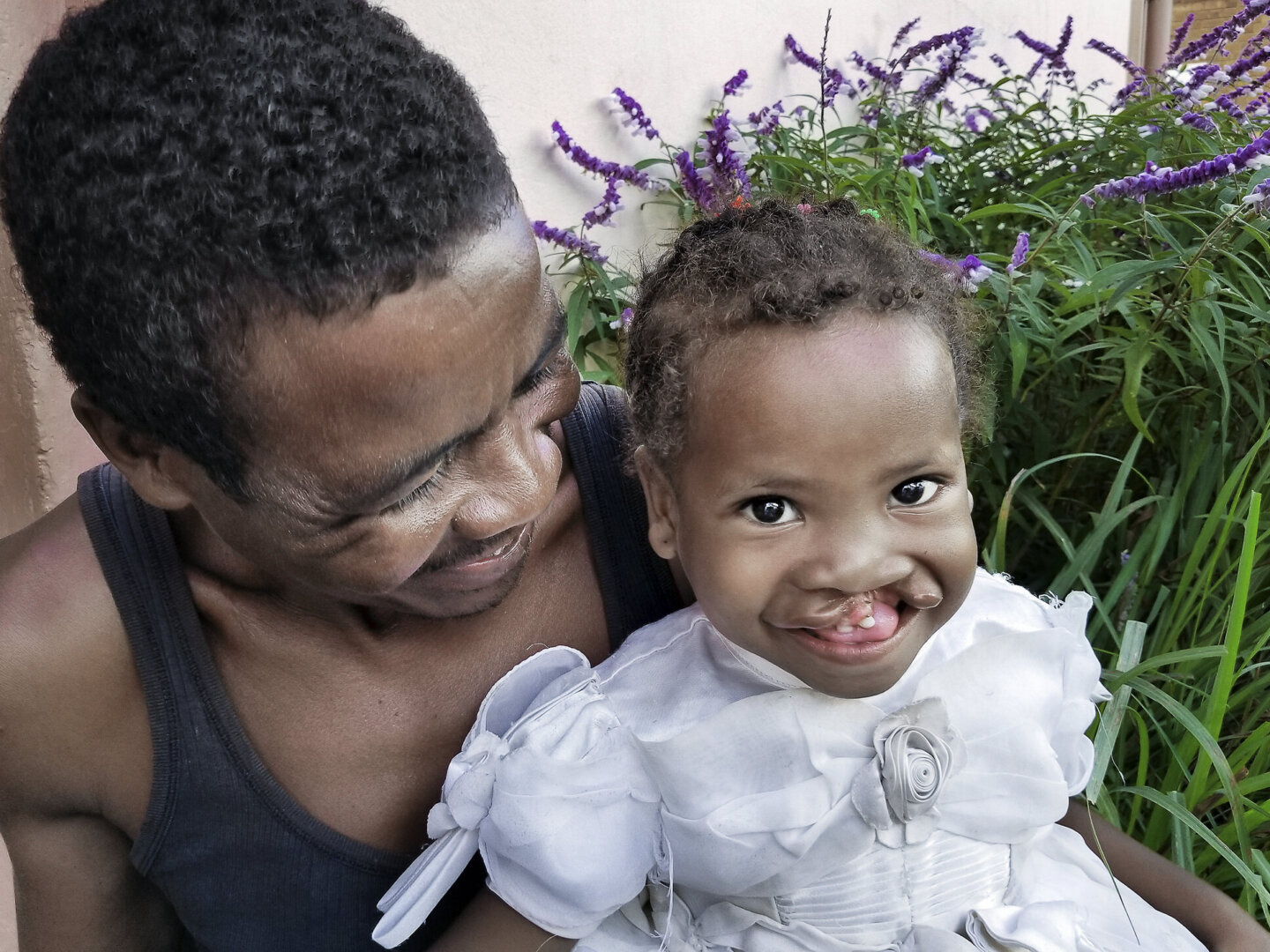 Brunel, before surgery, shares a smile with her father.