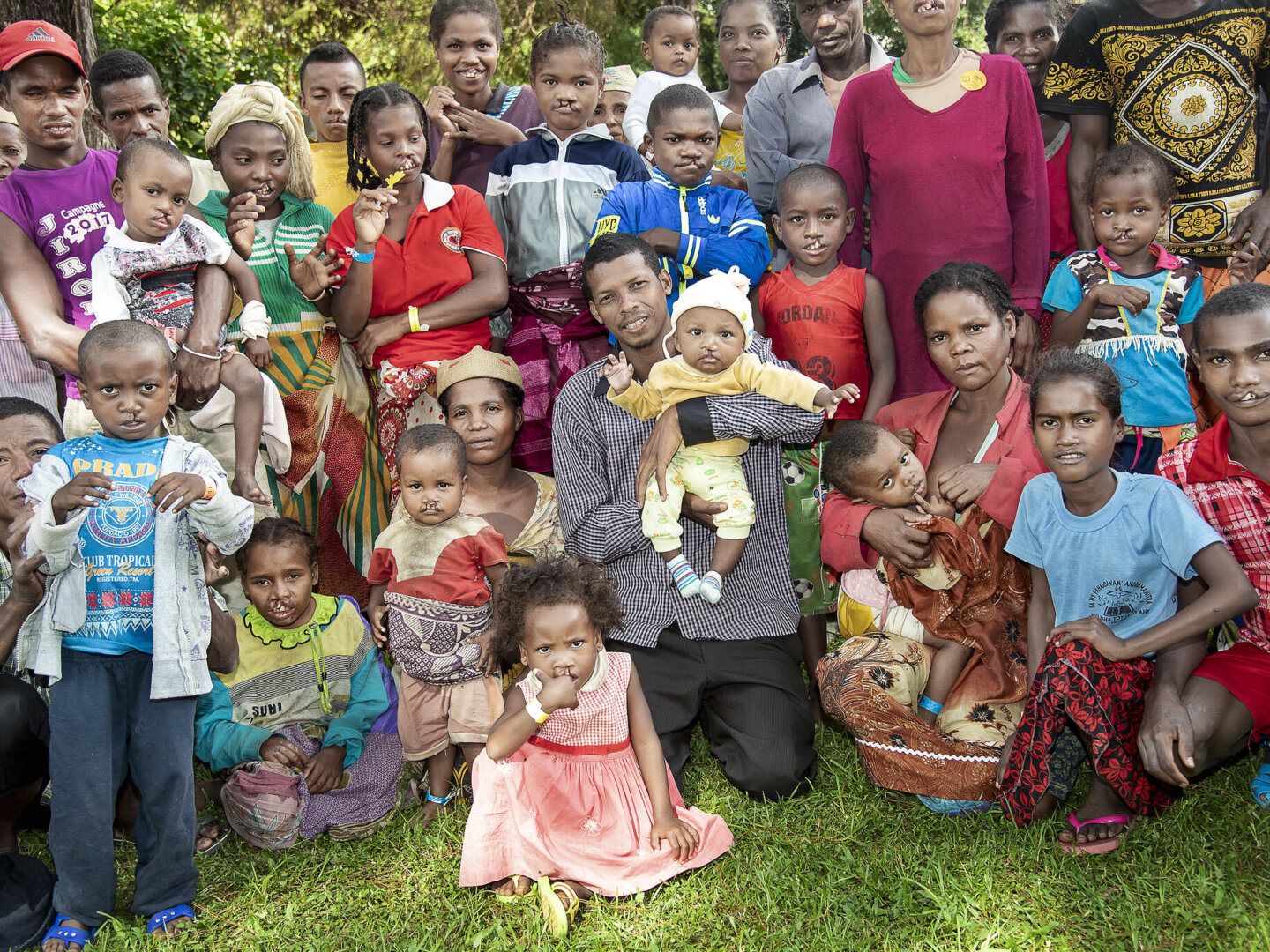 Fidelis, pictured here in the center, poses with some of the 42 patients and their family members who he has helped bring to Operation Smile’s care in Madagascar as a patient advocate.