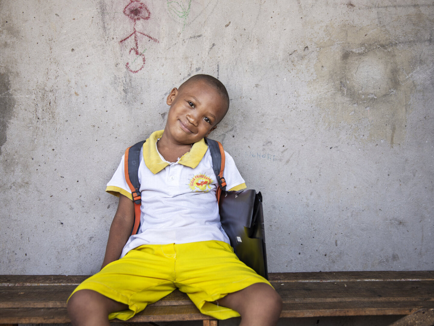 Honore, after surgery.