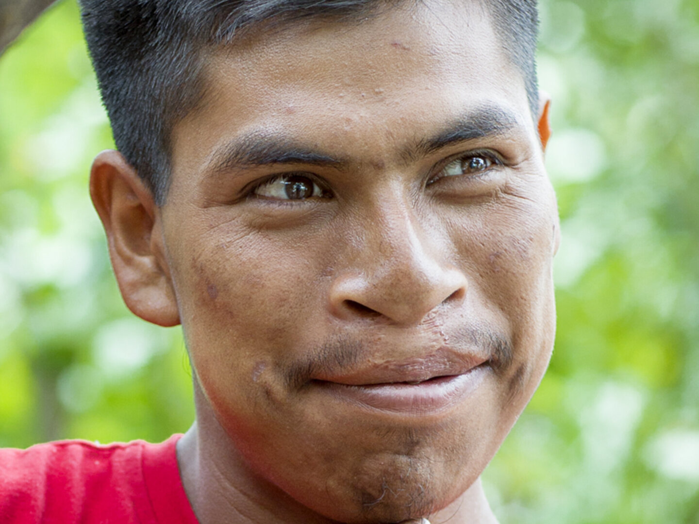 Virgilio, after surgery.