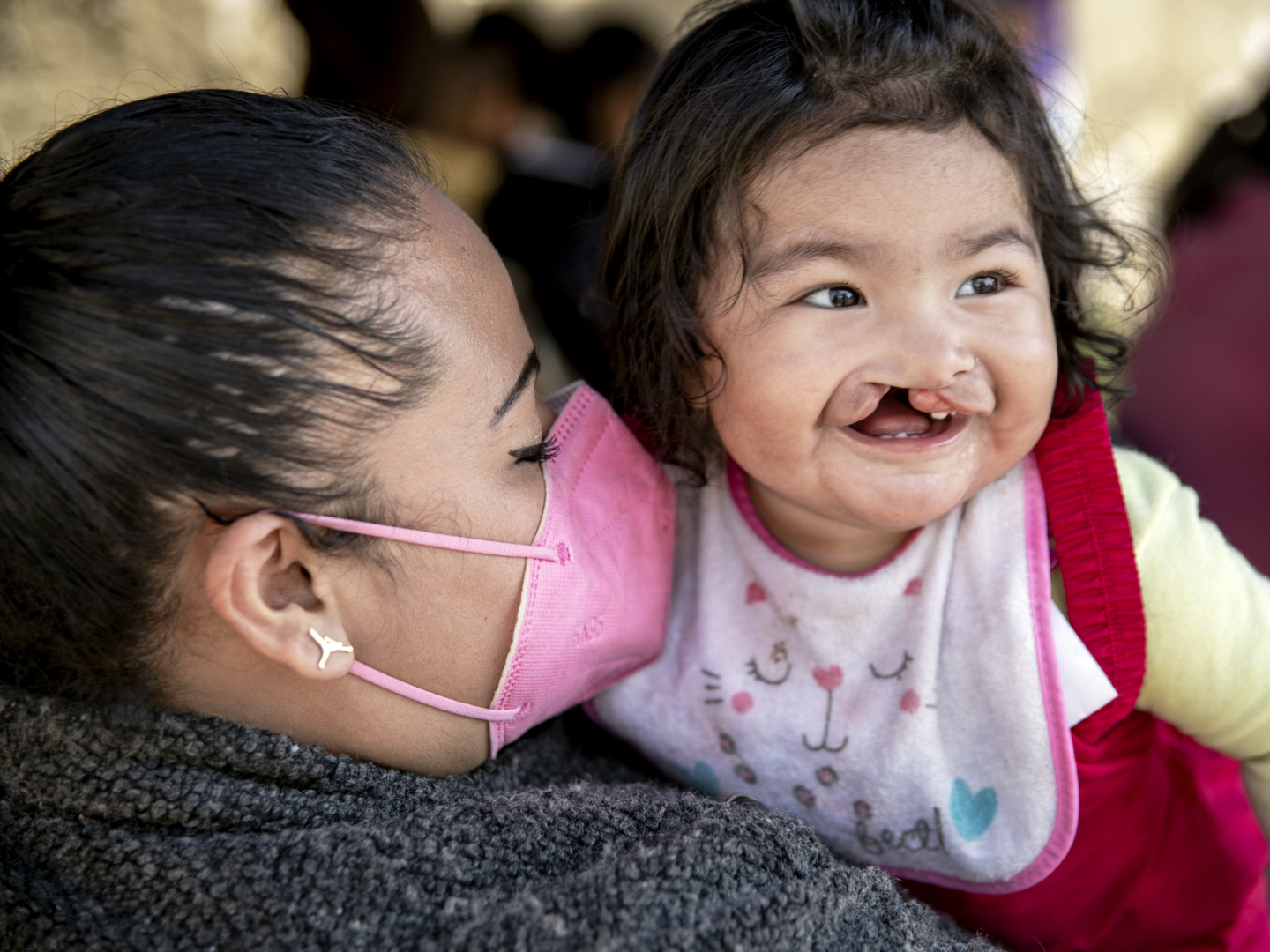 Lilia, held by her mom, Valeria, before surgery. Lilia received comprehensive cleft care from Operation Smile.