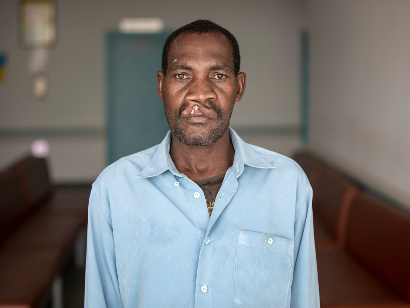 Domingos, before surgery.