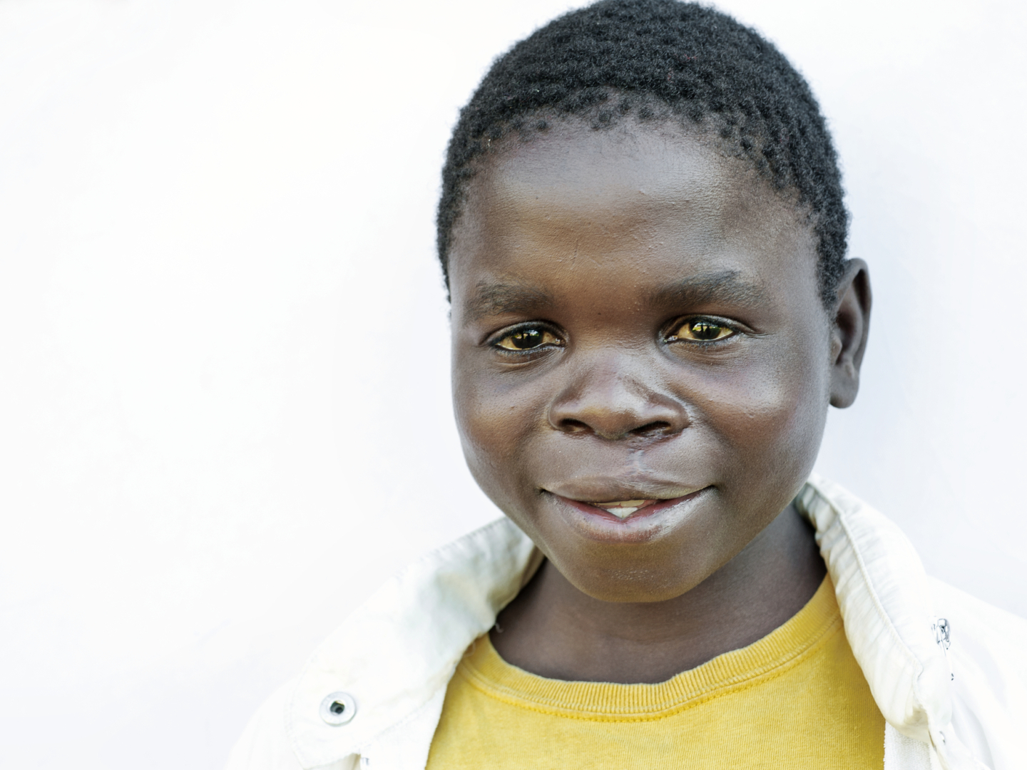 Cosmas, one year after his surgery.