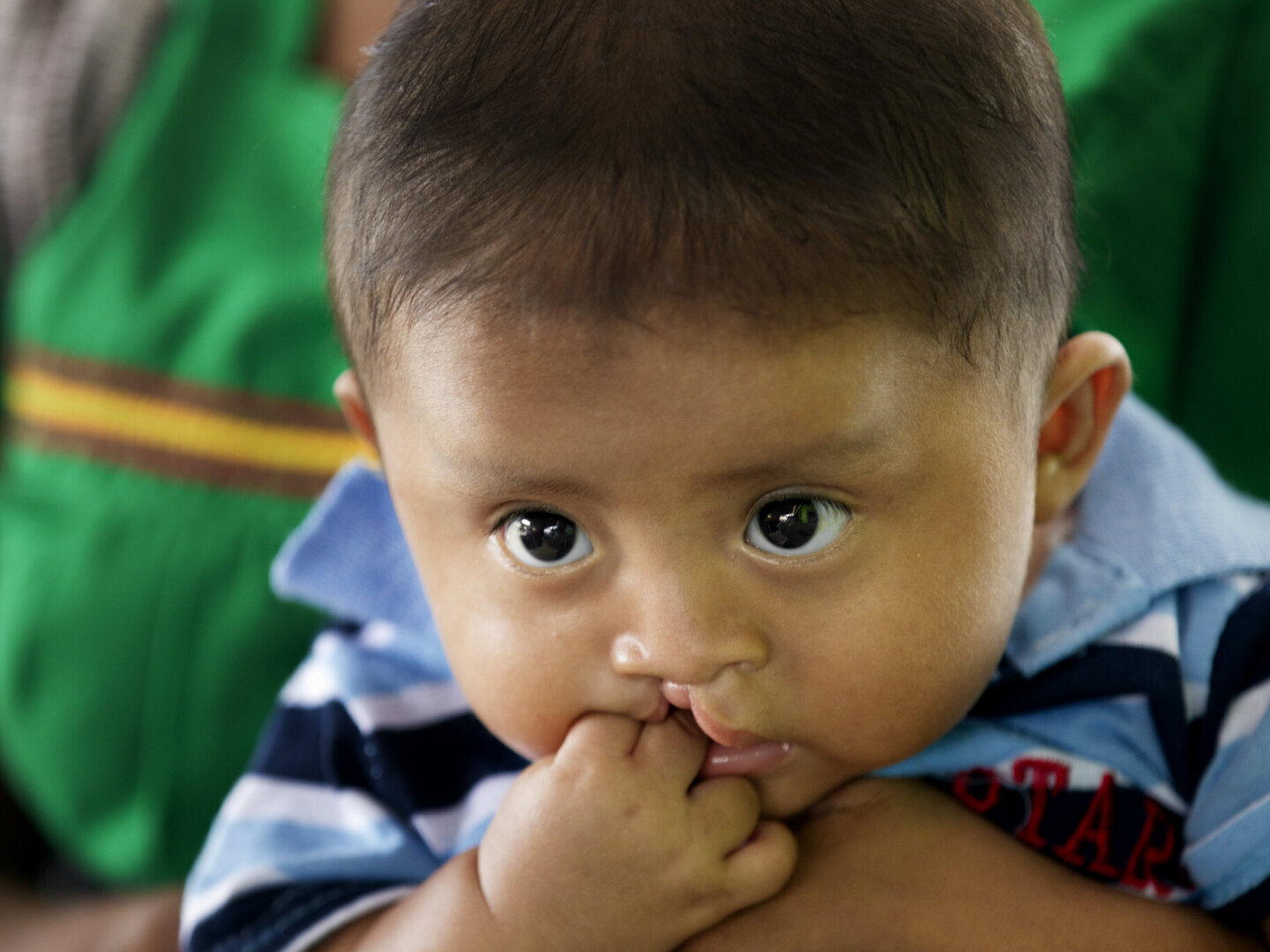 A patient chews his fingers before a surgical program in Panama.