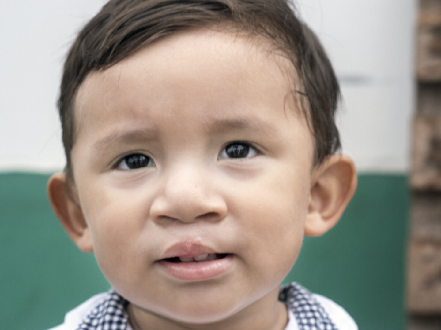 Andrews, after surgery.