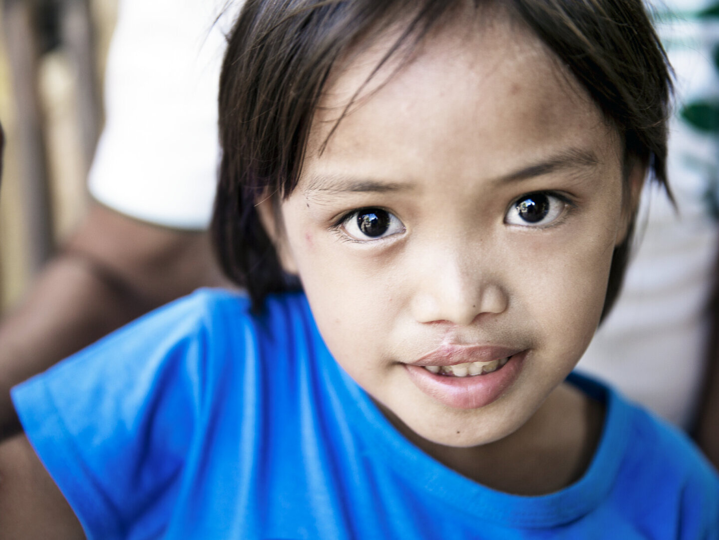 Jane Rose, after surgery.