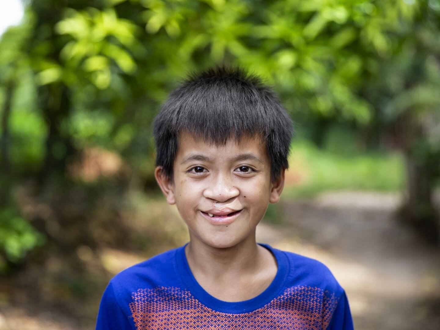 After receiving his surgery, Joseph smiles for the camera.