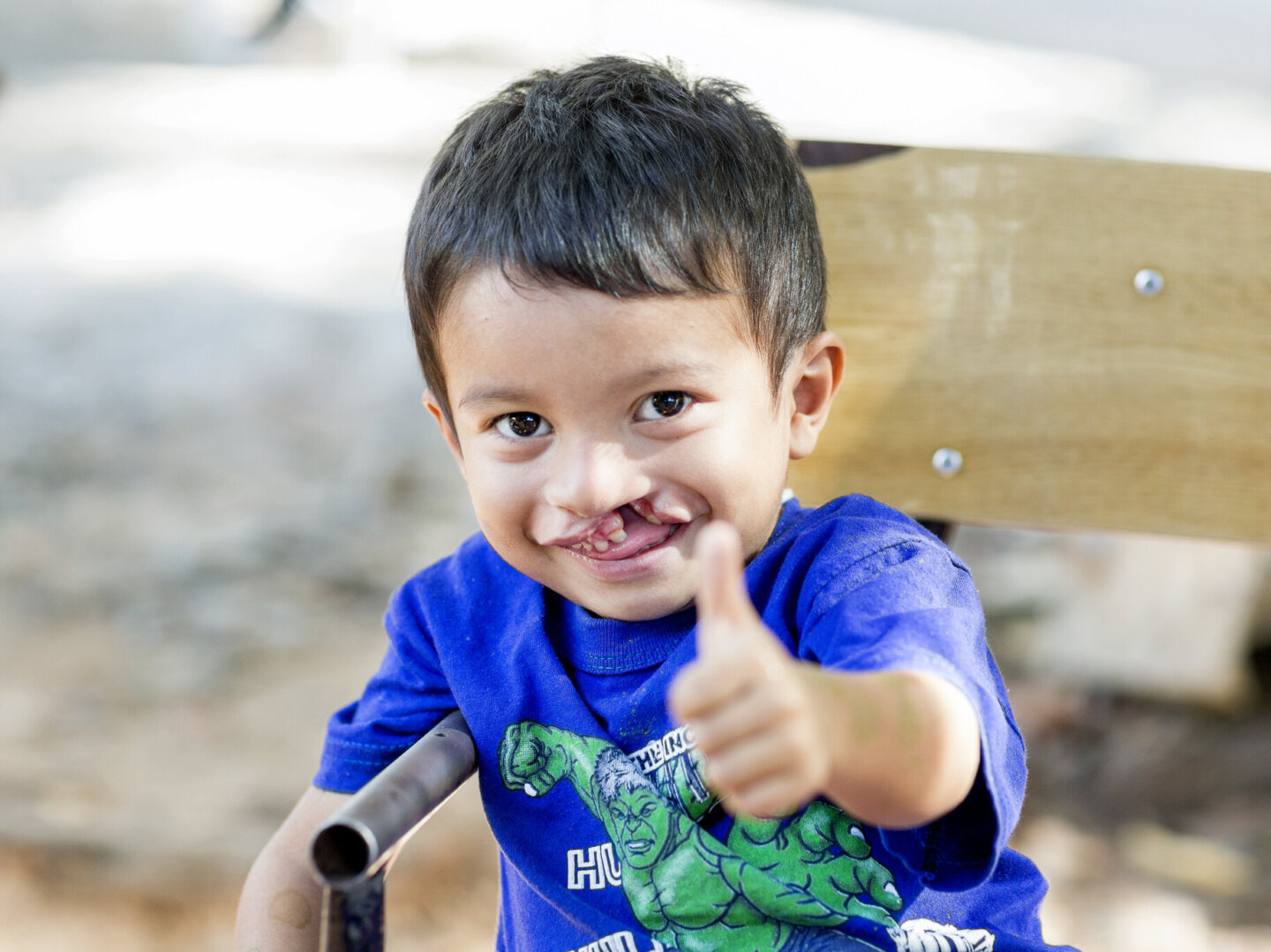 A patient gives the thumbs up during a surgical program in Asuncion.
