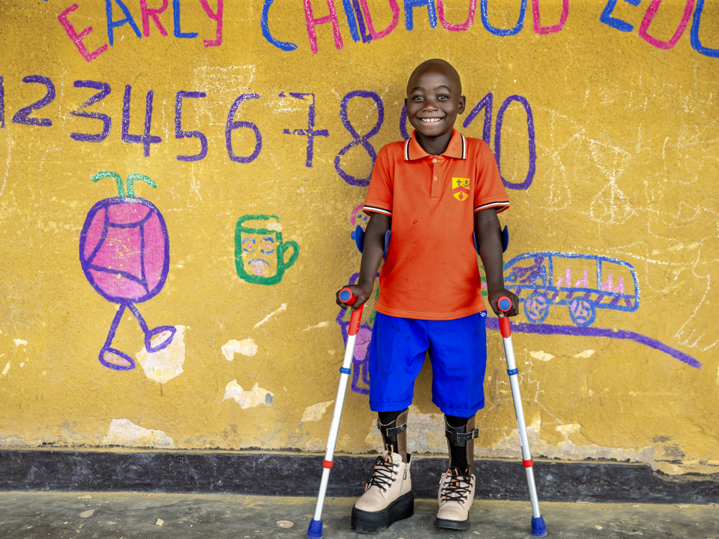 Chris Joy smiles for the camera after surgery.