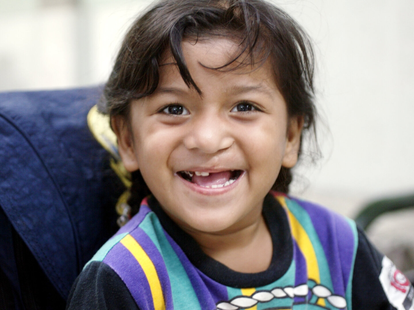 Daniela, before surgery.