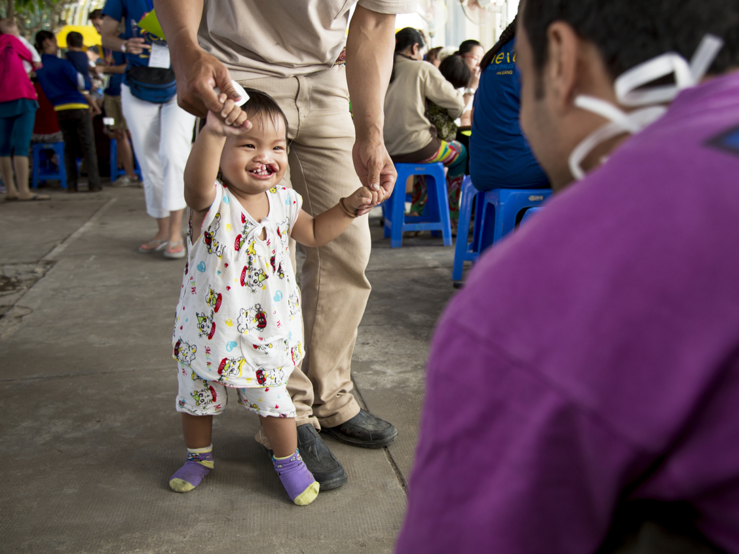 Nguyen smiles wide before surgery during a 2015 Operation Smile Vietnam surgical program. Nguyen is one of the many patients Operation Smile has treated in Asia and the Pacific.