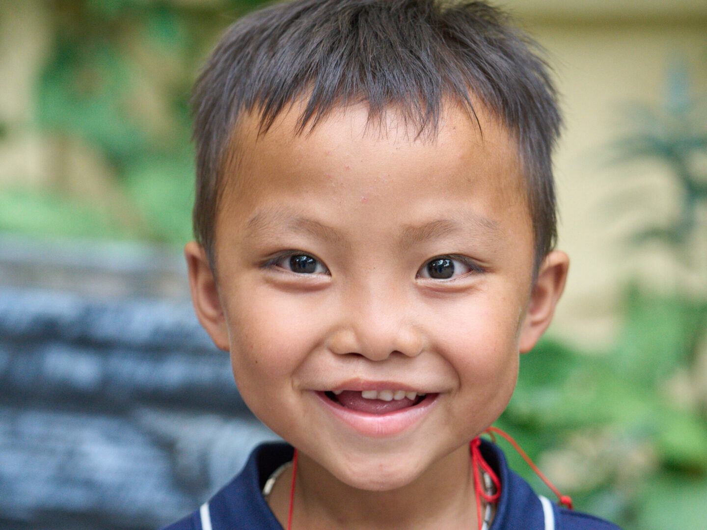 A patient smiles during a surgical program in Vietnam. Your donation supports patients like him.